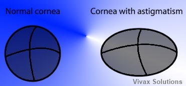 cause of astigmatism